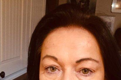 La mujer comió fuegos pirotécnicos y casi pierde la dentadura.