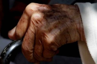 La señora luchó por comer sus alimentos pero se atragantó.