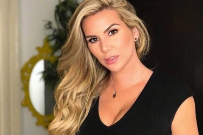 Carolina Jaume tiene psoriasis.