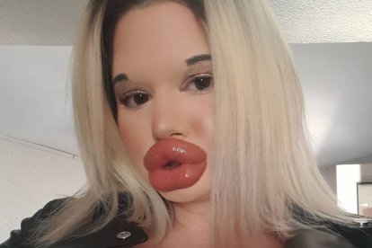 Andrea Ivanova es la mujer con los labios más grandes del mundo.