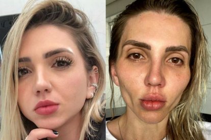 La influencer dio a conocer su experiencia para quienes quieran hacerse la misma operación.