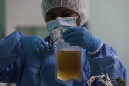 Con el suero se espera ayudar a los casos moderados y severos de coronavirus.