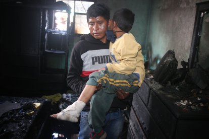 Agustín Daquilema carga a su hijo, quien sufrió quemaduras en una de sus extremidades.