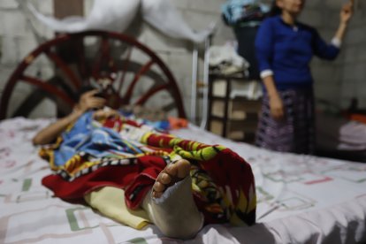 La mamá del adolescente cuida de él en su inmueble.