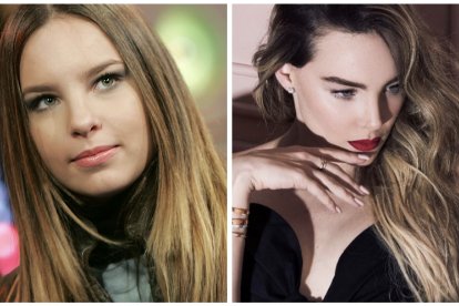 Belinda. Cuando era adolescente, su cara era redonda; la bichectomía realzó sus facciones.