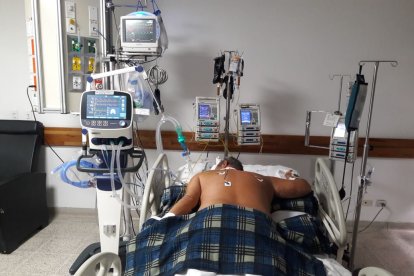 Los pacientes afectados gravemente con Covid-generalmente han sido intubados en las UCI