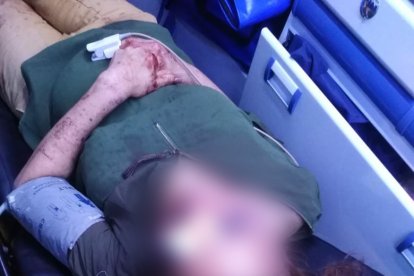 La adulta mayor tiene hematomas en el rostro y fracturadas las costillas.