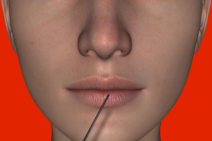 Tiene sus ventajas y desventajas.