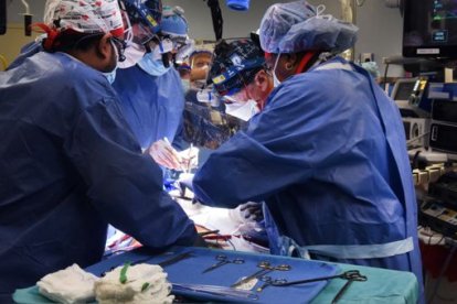 Médicos realizando el complicado pero exitoso transplante.