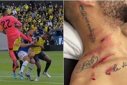 La patada de Domínguez le causó una herida visible en el cuello.