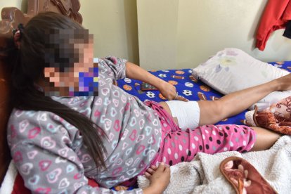 La mujer no sabe cómo conseguirá dinero mientras se recupera de su herida.