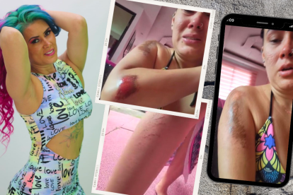 Zully sufrió varias lesiones en su cuerpo tras la caída.