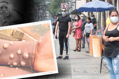 El virus produce pústulas parecidas a la de la varicela. La población se siente ‘relax’.