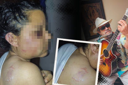 Familiar del artista se recupera en su hogar.