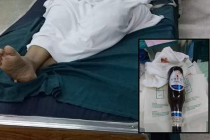 El incidente ocurrió en Irán. El afectado  aguantó el dolor por temor a su esposa.