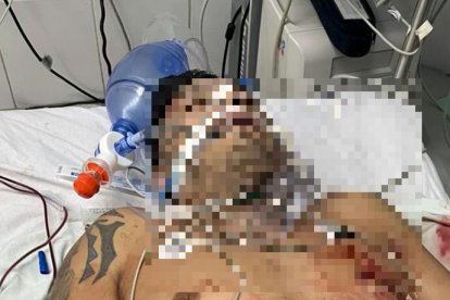 Los médicos trataron de ayudar al herido, pero las balas comprometieron sus órganos.