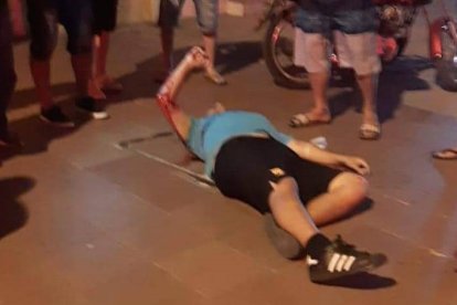 El perjudicado fue llevado a un hospital. Sin embargo, por la gravedad falleció.