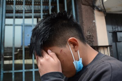 Lo hirieron incluso en la cara. A su hermano también le pegaron.