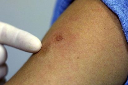 A un mes del anuncio del primer caso, ya suman siete los contagios en el país.