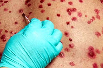 Según Salud, el menor contrajo el virus en la provincia de Los Ríos por "contacto estrecho" durante sus vacaciones.