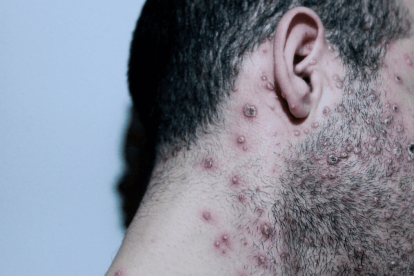 Referencial. Durante el feriado se confirmaron los dos últimos en Azuay y Cañar.