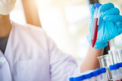 Prueban una nueva estrategia de vacunación para combatir el VIH