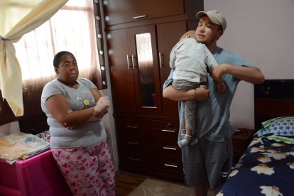 Patricia tienen vitiligo, condición que le costó su trabajo en un restaurante. Ambos padres se turnan los cuidados de la menor.