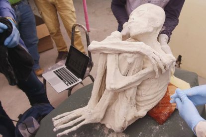 El microcirujano en reconstrucción de manos Mirko Tello determinó que no había manipulación en sus manos”.