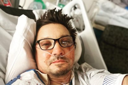 Después del incidente, el actor que da vida a Ojo de Halcón fue trasladado por aire a un hospital cercano donde fue intervenido quirúrgicamente.