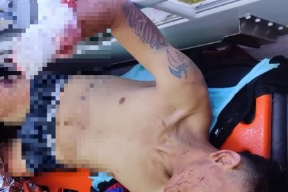 La mano del presunto choro estaba cerca de la moto incinerada.