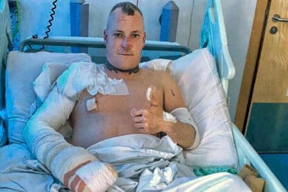 Kevin Record, dueño del can, sufrió algunas quemaduras.