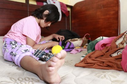 Kristin convive con su lesión y no pierde la esperanza de convertirse en abogada.