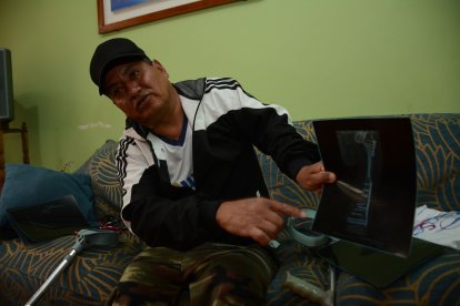 Washington enseña las radiografías que muestra el estado de su cadera y fémur. No puede moverse sin muletas.