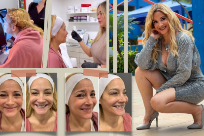 La presentadora se realizó un tratamiento de bótox en su rostro.