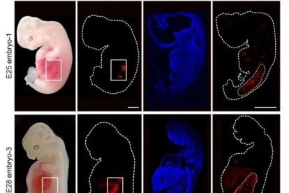 Riñones humanos en embriones de cerdo