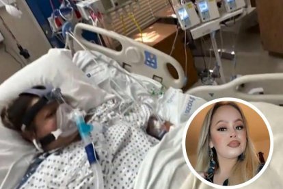 La FDA advierte sobre la gravedad de esta infección, especialmente para personas con enfermedades subyacentes.