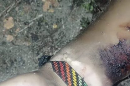 El cadáver tenía signos de violencia.