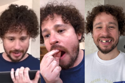 El 'Livestream' terminó abruptamente cuando el 'influencer' extrajo dos dientes de su boca