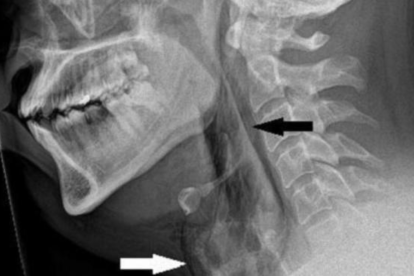 Este ha sido el primer caso registrado en el mundo.