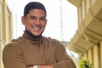 Emilio Pinargote se hizo injerto de cabello en la barba.