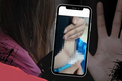 La menor de edad tiene una cicatriz de 60 centímetros en su abdomen. El objeto le perforó el útero y los intestinos.