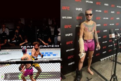 Sean O’Malley salió cojeando en pelea contra Chito Vera