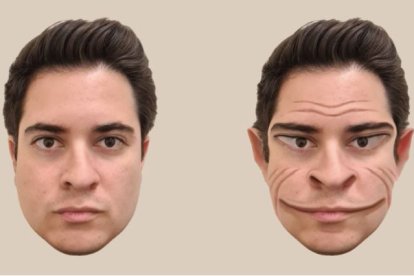 Ilustración de cómo la percepción del paciente distorsiona la apariencia de una persona normal.