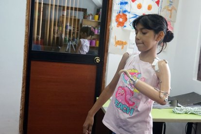 El brazo izquierdo de la pequeña fue reemplazado ahora por una prótesis.