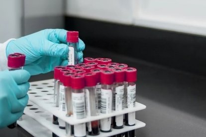 Envases de muestras de sangre para su analisis