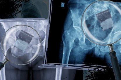 Los investigadores hicieron una revisión y determinaron que las mujeres escondían sustancias ilícitas.