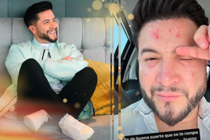 Jorge Heredia sufrió un accidente en su rostro.