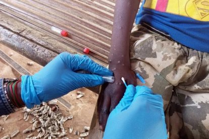 La enfermedad es endémica en África, pero ya se han registrado casos en Europa y Estados Unidos