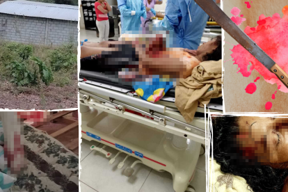 Madre e hija fueron atacadas a machetazos cuando dormían.