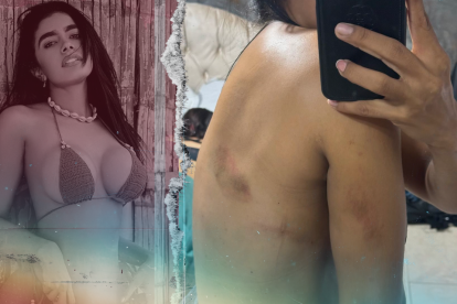 Andreína Díaz denunció haber sido agredida, supuestamente, por su expareja.